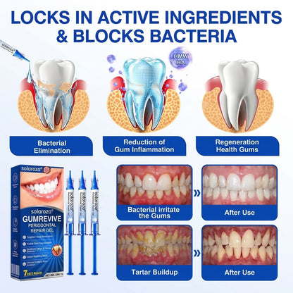 🎁🦷🛡️  Solaroza®  GumRevive Advanced Gum Care & Repair Gel🌞